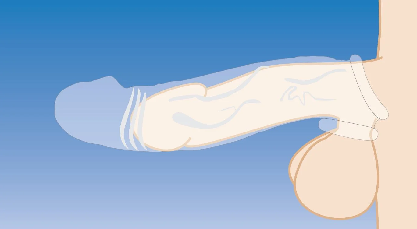 Clear Extender Gebogen Penissleeve